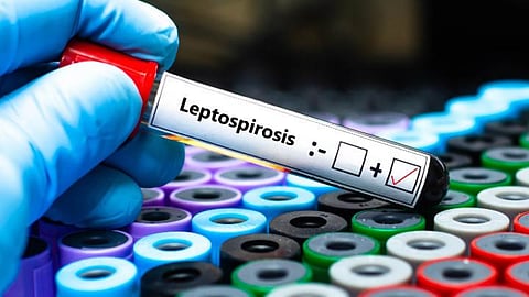 leptospirosis