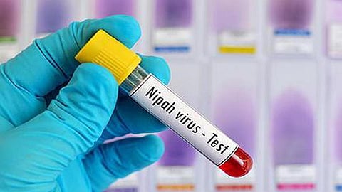 nipah virus 