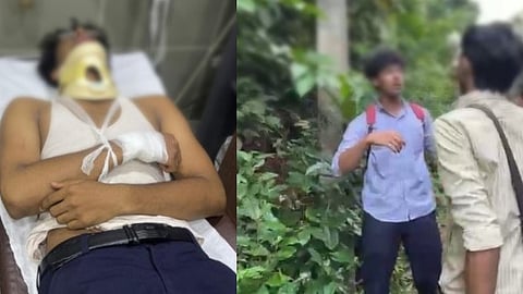'ഷർട്ടിൻ്റെ ബട്ടൺ ഇട്ടില്ല, പാട്ടും പാടണം'; കണ്ണൂരിൽ സീനിയേഴ്‌സിൻ്റെ റാഗിങ്ങിൽ പ്ലസ് വൺ വിദ്യാർഥിക്ക് ഗുരുതര പരുക്ക്
