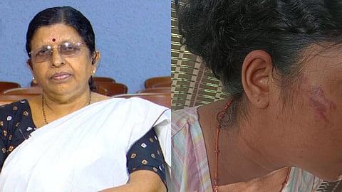 കൊല്ലത്ത് യുവതിയെ ഭർതൃവീട്ടുകാർ ക്രൂരമായി മർദിച്ച സംഭവം; റിപ്പോർട്ട് തേടി വനിത കമ്മീഷന്‍