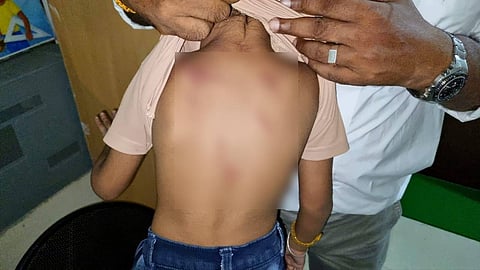 കൊച്ചിയില്‍ മൂന്നര വയസുകാരന് അധ്യാപികയുടെ ക്രൂരമര്‍ദനം