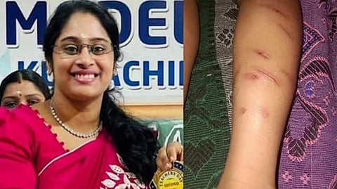 തൃശൂരിൽ അഞ്ച് വയസുകാരനെ മര്‍ദിച്ച സംഭവം; അധ്യാപിക സെലിനെ നെടുപുഴ പൊലീസ് അറസ്റ്റ് ചെയ്തു