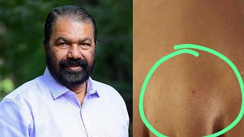 ക്ലാസ് മുറിയിൽ ഏഴാം ക്ലാസുകാരിക്ക് പാമ്പുകടിയേറ്റ സംഭവം;  അന്വേഷണത്തിന് ഉത്തരവിട്ട് വിദ്യാഭ്യാസ മന്ത്രി