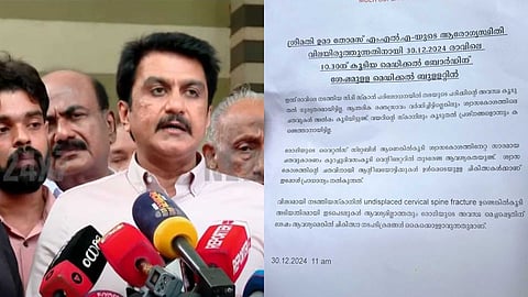 ഉമ തോമസ് വെന്റിലേറ്ററില്‍ തുടരും;  ശ്വാസകോശത്തിനേറ്റ ചതവുകള്‍ കൂടി, ആന്തരിക രക്തസ്രാവം വര്‍ധിച്ചിട്ടില്ല: മെഡിക്കല്‍ ബുള്ളറ്റിന്‍