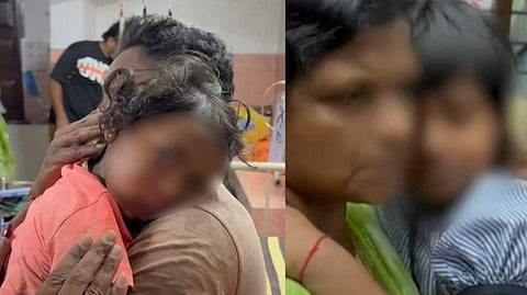 വണ്ടിപ്പെരിയാറില്‍ തെരുവുനായ ആക്രമണത്തില്‍ രണ്ട് പെൺകുട്ടികള്‍ക്ക് പരിക്ക്; മൂന്ന് വയസുകാരിയ്ക് കടിയേറ്റത് മുഖത്ത്