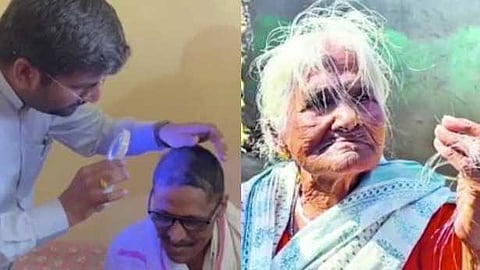 മഹാരാഷ്ട്രയിൽ കുട്ടികൾക്ക് ഉൾപ്പെടെ കഷണ്ടി; വില്ലനായത് റേഷൻ ഗോതമ്പെന്ന് കണ്ടെത്തൽ
