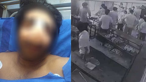 "മൂക്കിൻ്റെ പാലം രണ്ടര സെൻ്റീമീറ്റർ അകത്തേക്ക് പോയി,  തമ്പോല ടീം നേരിടുമെന്ന് ഭീഷണിപ്പെടുത്തി";  സാജൻ്റെ ആരോഗ്യസ്ഥിതി അതീവ ഗുരുതരമെന്ന് കുടുംബം