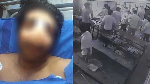 വിദ്യാർഥിയുടെ മൂക്കിൻ്റെ പാലം തകർത്ത സംഭവം: 'കേസ് ഒതുക്കി തീർക്കാന്‍ ശ്രമം'; കുട്ടിയുടെ മൊഴിപോലും എടുത്തില്ലെന്ന് പിതാവ്