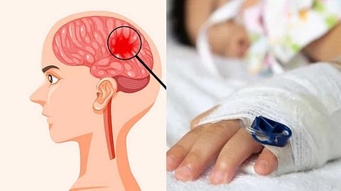 കളമശേരിയില്‍ രണ്ടാം ക്ലാസ് വിദ്യാര്‍ഥിക്ക് മെനിഞ്ചൈറ്റിസ്; രോഗലക്ഷണങ്ങളോടെ ആറ് കുട്ടികള്‍ നിരീക്ഷണത്തില്‍
