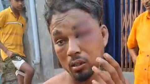 ഇതര സമുദായത്തിൽപ്പെട്ട 16കാരിയോട് സംസാരിച്ചു; ഛത്തീസ്‌ഗഢിൽ ദളിത് യുവാവിനെ നഗ്നനാക്കി മരത്തിൽ കെട്ടിയിട്ട് മർദിച്ചു
