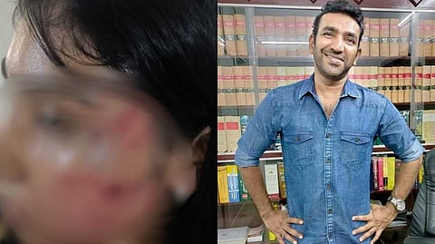 അഭിഭാഷകന്‍റെ അടിയില്‍ ശാമിലി നിലത്ത് വീണു; എഴുന്നേറ്റപ്പോള്‍ വീണ്ടും മുഖത്ത് ആഞ്ഞടിച്ചു; എഫ്‌ഐആറിന്റെ പകര്‍പ്പ് പുറത്ത്