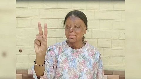 ആസിഡ് ആക്രമണത്തില്‍ കണ്ണുകള്‍ നഷ്ടപ്പെട്ടു; ഈ മിടുക്കി 12ാം ക്ലാസില്‍ നേടിയത് 95.6% വിജയം