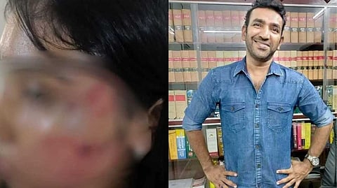 ''ബോധപൂര്‍വം ആക്രമിച്ചിട്ടില്ല''; ജൂനിയര്‍ അഭിഭാഷകയെ മര്‍ദിച്ചെന്ന പരാതിയില്‍ മുന്‍കൂര്‍ ജാമ്യപേക്ഷയുമായി ബെയ്‌ലിന്‍ ദാസ്
