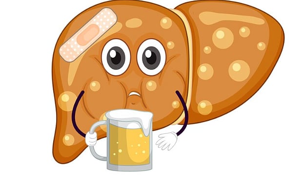 Fatty Liver