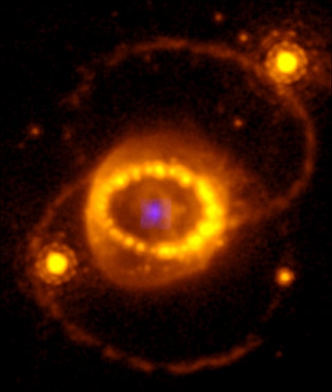 Neutron Star- Supernova 1987