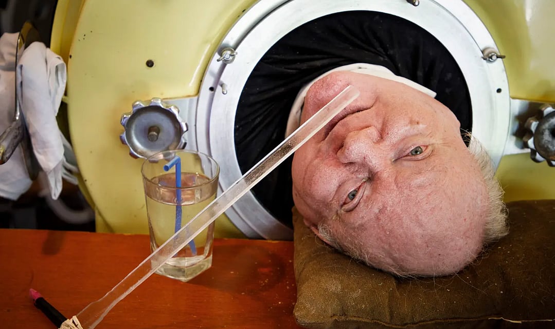 AP : Paul Alexander, The Man In The Iron Lungs