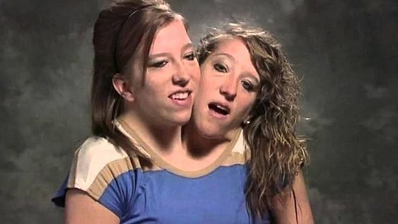 Pinterest : Abby and Brittany Hensel