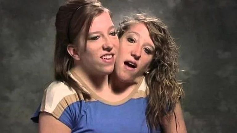 Abby and Brittany Hensel - Pinterest