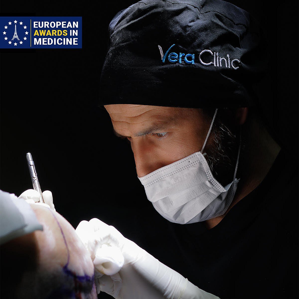 Basics Of Hair Transplant Istanbul 2024 & Vera Clinic’s Exclusive Brighton Sponsorship