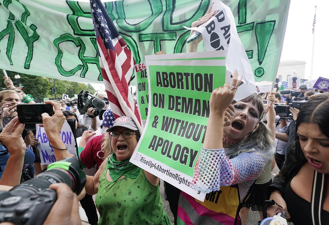 AP : The US abortion landscape