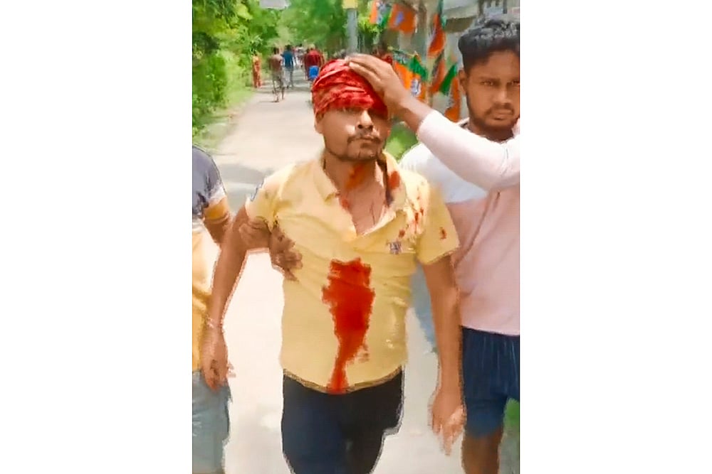 An injured in 2024 Lok Sabha Poll violence