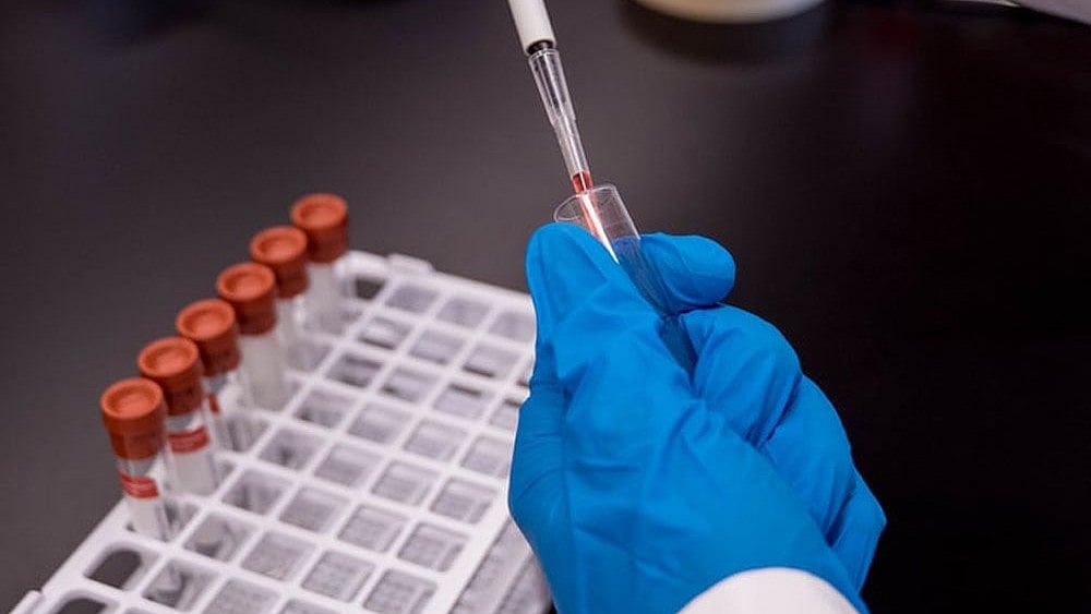 Representative Picture For Dope Testing  - File