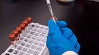 File : Representative Picture For Dope Testing 