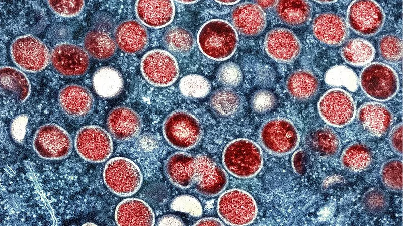 Mpox virus