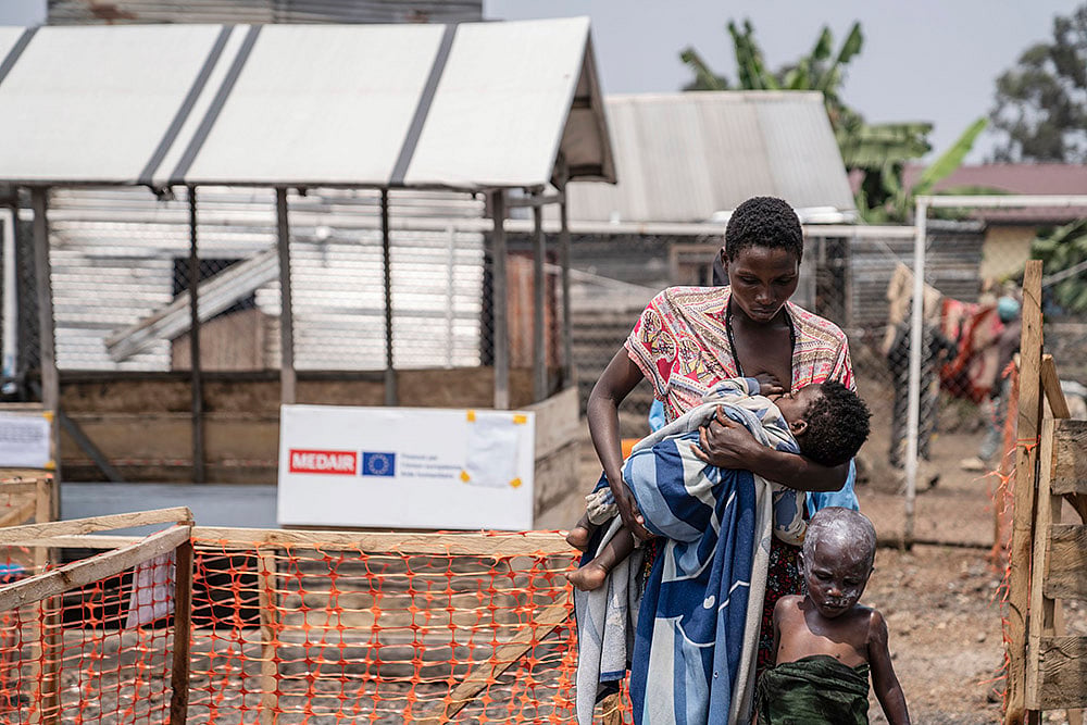 Mpox: Congo Monkey pox outbreak_9