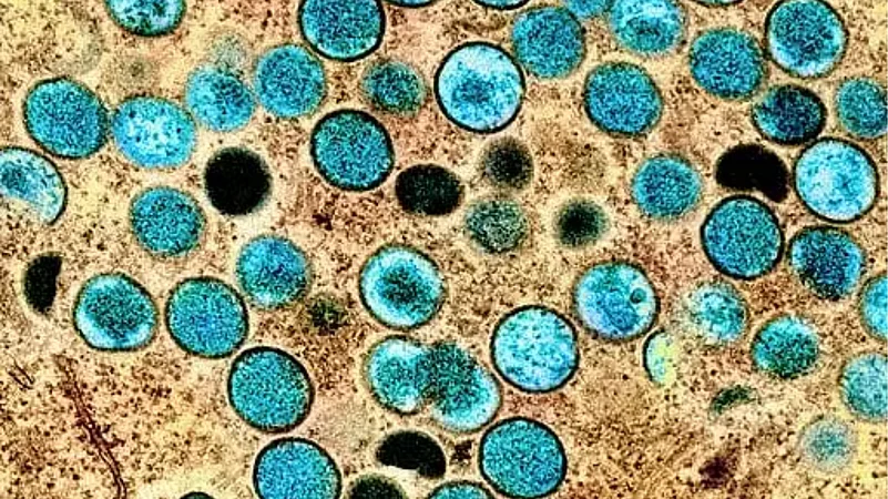 mpox outbreak who alert