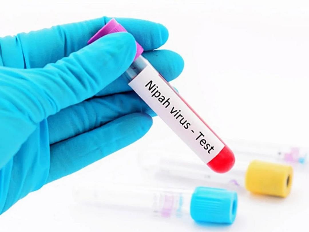 Kerala Nipah virus outbreak.(Representational image) |