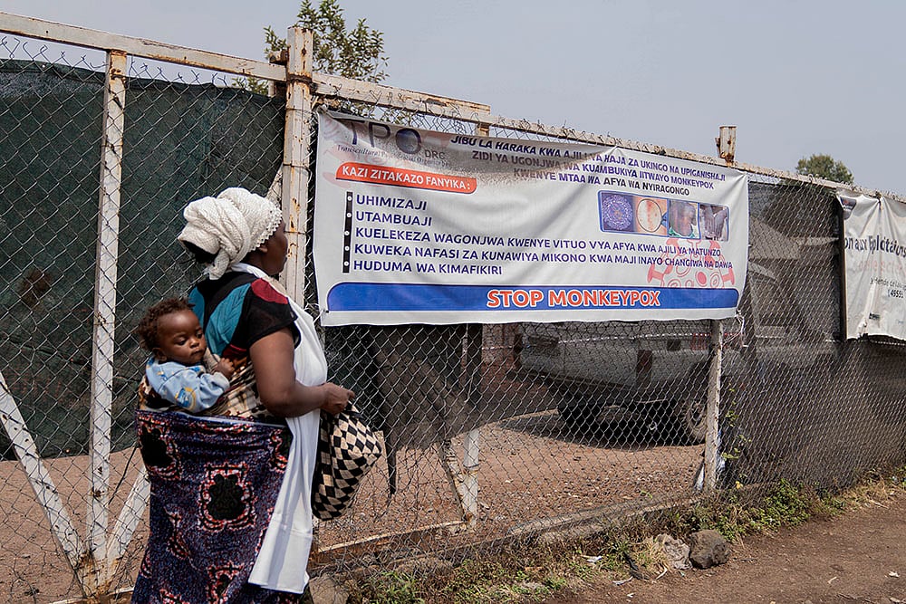Mpox: Congo Monkey pox outbreak_5