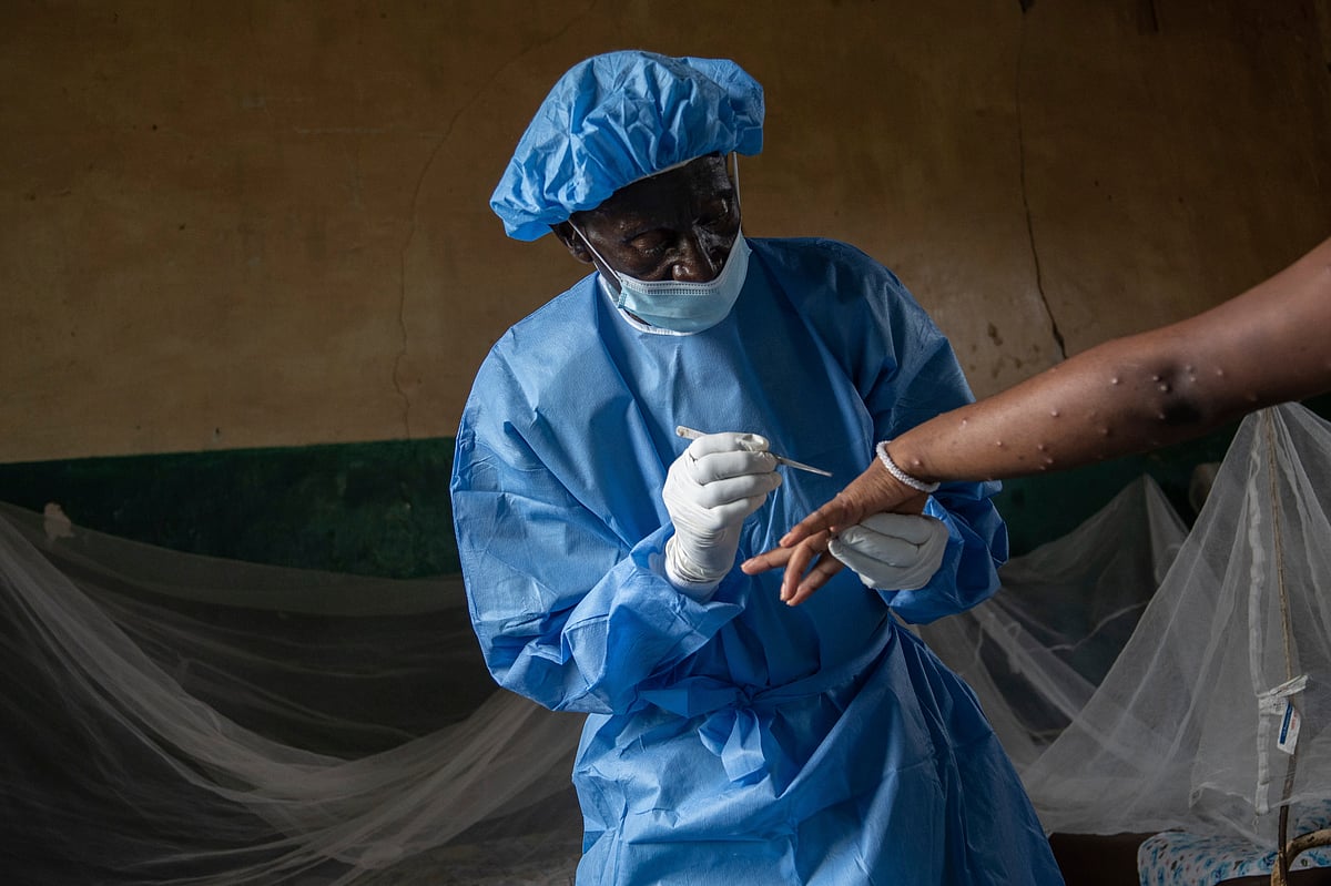 AP : 
Mpox, originating in the African continent, was first detected in humans in 1970, in the Democratic Republic of Congo (DRC). 