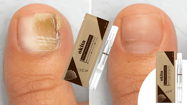 What Does Okita Toenail Fungus Pen Do