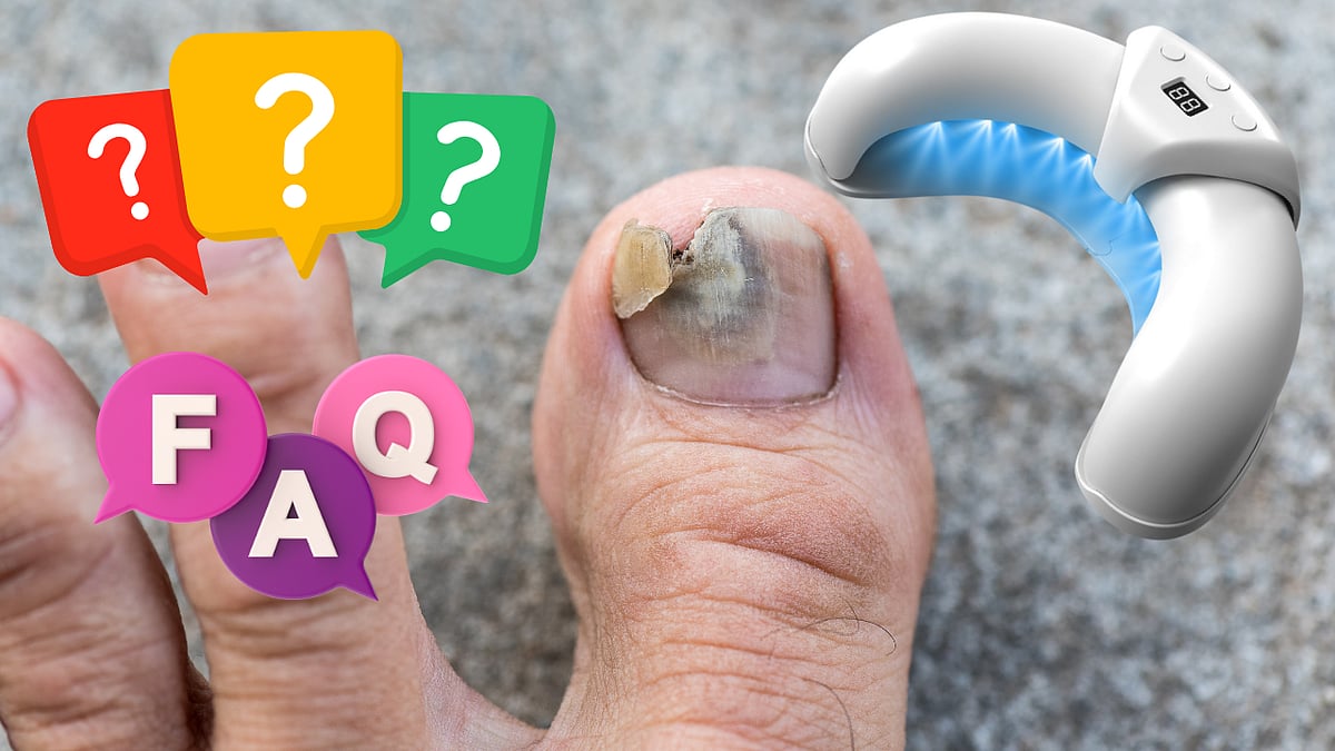 Frequently Asked Questions (Faqs)