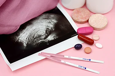 Prenatal Vitamins: Benefits For Pregnancy & Baby's Health