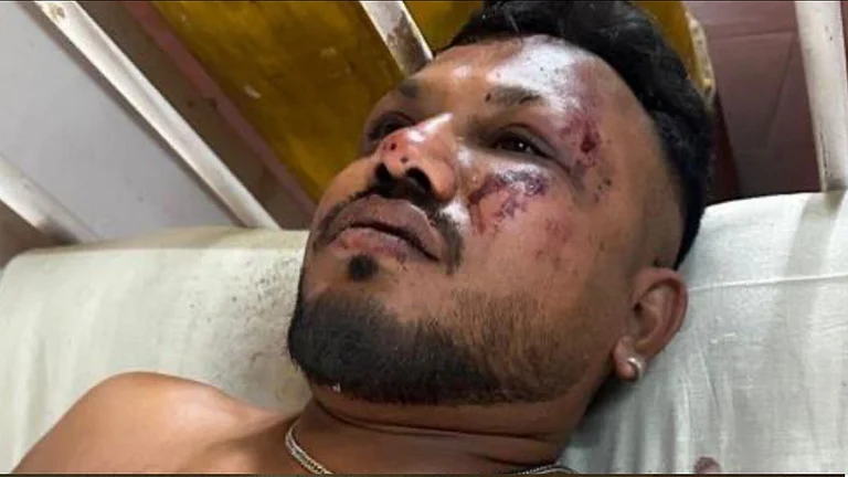 Viswaskumar Ramesh, the sole survivor of the Air India plane crash in Ahmedabad. - X/@AnshulGarg1986