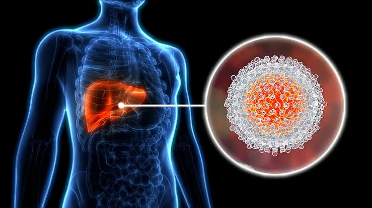 Hepatitis Infection Infographic