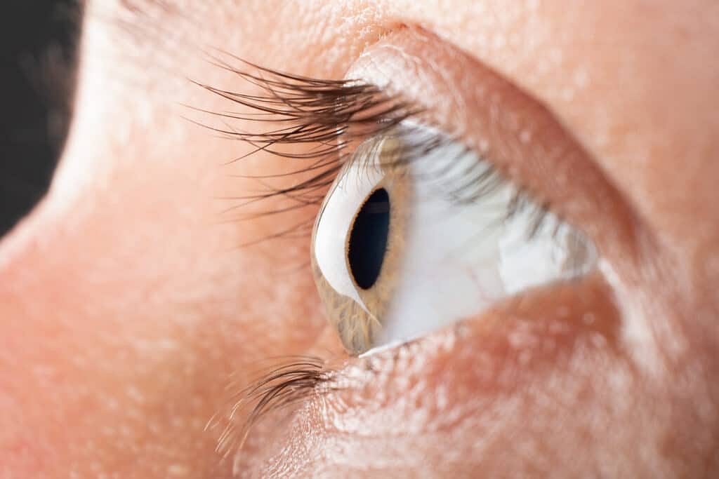 Corneal Blindness No Longer Just An Elderly Concern: Eye Injuries And Infections Threaten Young Indians