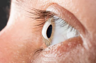 Corneal Transplants Rise, But Shortage Of Donor Tissue Leaves Thousands Waiting