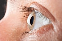 Corneal Transplants Rise, But Shortage Of Donor Tissue Leaves Thousands Waiting