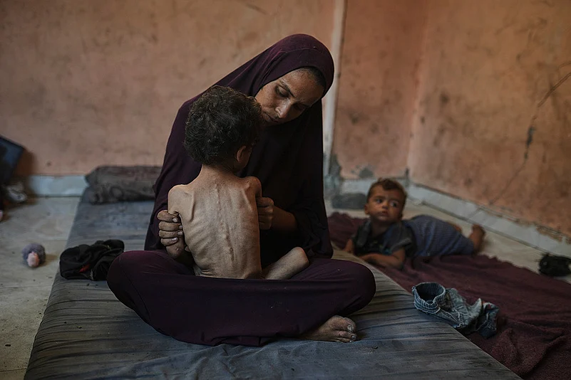 2 year old child in Gaza, starving to death