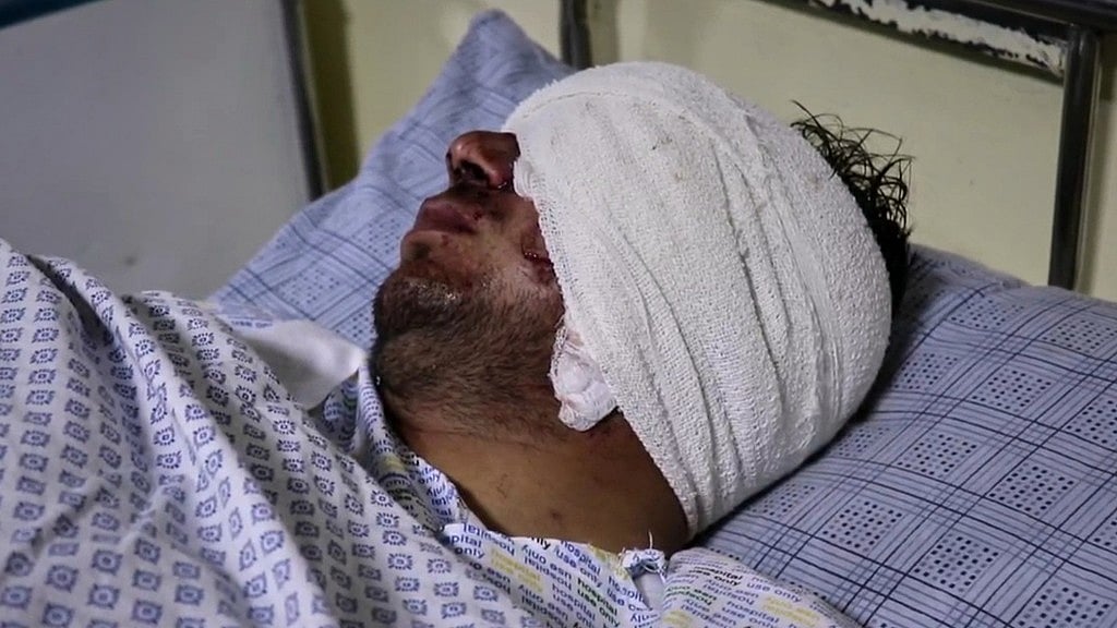 AP : Cricketer Mira Jan lies wounded in a hospital bed after a Pakistani cross-border airstrike that killed several people, including three local cricketers, at the regional hospital in Afghanistan's eastern Paktika province.
