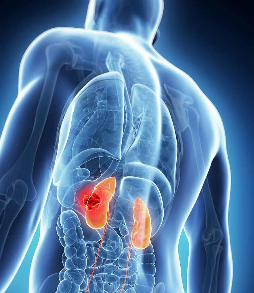 IIT Bombay Scientists Discover Blood Biomarkers For Early Diabetes Detection