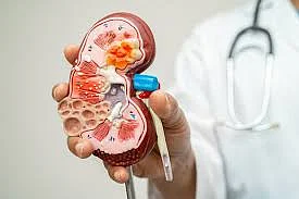 A doctor holding a model of a kidney