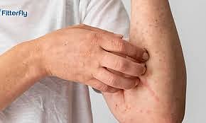 Skin Disorders Can Signal Early Or Uncontrolled Diabetes, Warns Dermatologist