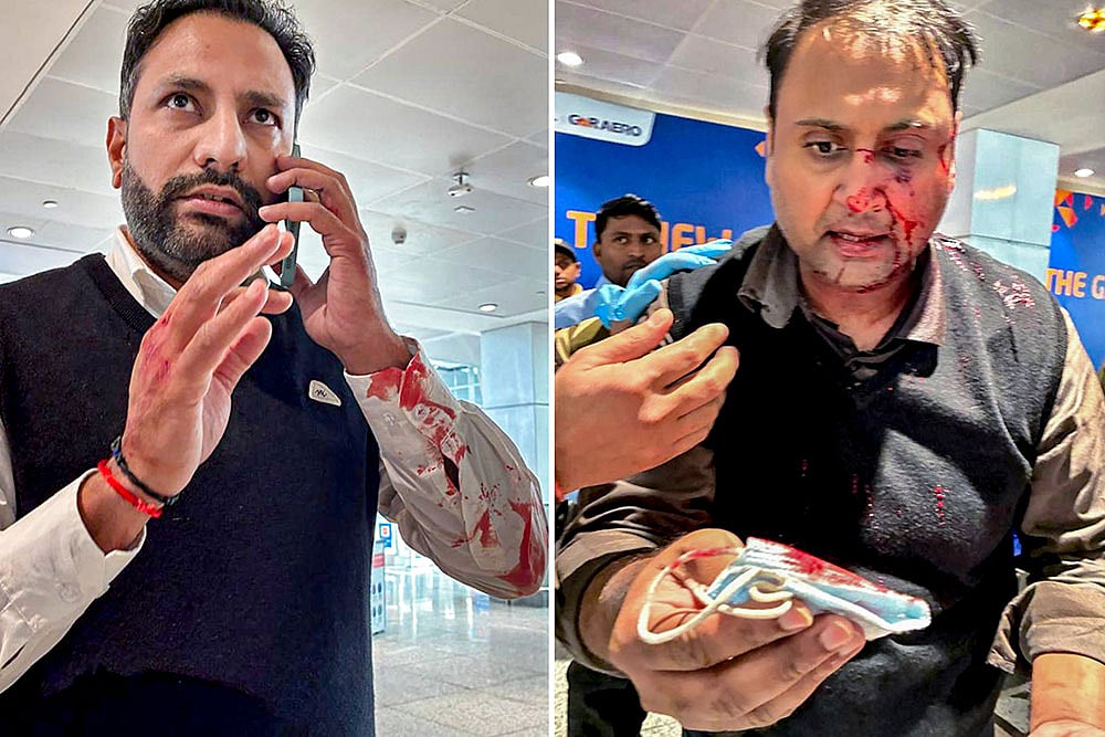 Passenger assaulted by Air India Express pilot