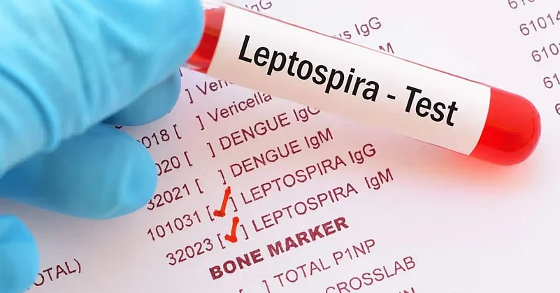 Leptospira test