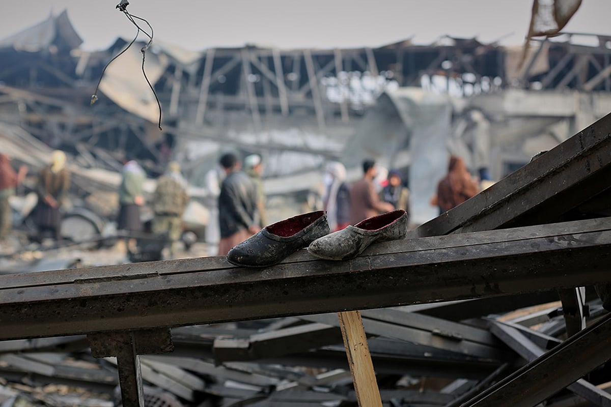 Pakistani Airstrike On Kabul Hospital