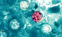 Cyclospora cayetanensis oocysts | CDC : Cyclospora cayetanensis oocysts | CDC